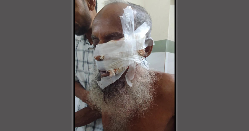 চাঁদপুরে শিয়ালের কামড়ে আহত ১০