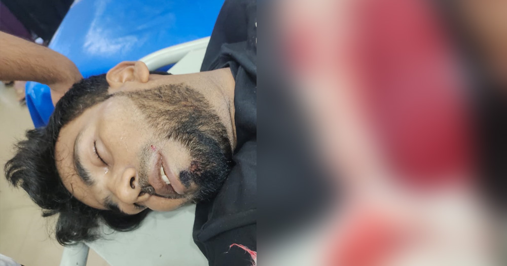 চাঁদা না পেয়ে প্রবাসীর হাতের কবজি কাটল সন্ত্রাসীরা