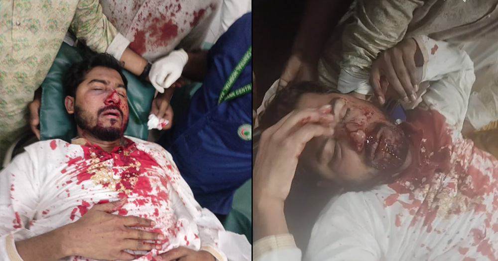 জাপা কার্যালয়ের সামনে ফের সংঘর্ষ, গুরুতর আহত ভিপি নুর
