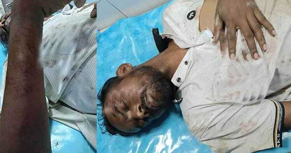 হিরো আলমের ওপর দুর্বৃত্তদের হামলা