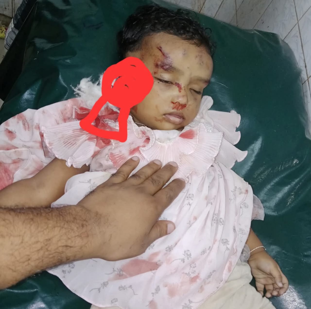 লক্ষ্মীপুরে বাবার মোটরসাইকেল থেকে ছিটকে পড়ে শিশুর মৃত্যু
