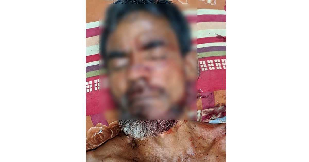 নাটোরে বাবা-ছেলেকে কুপিয়ে গুরুতর জখম করেছে বিএনপি নেতা