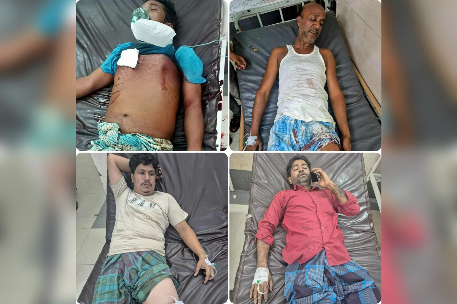 চট্টগ্রামের রাউজানে আবারও অস্থিরতা গোলাগুলি ,আহত ৫