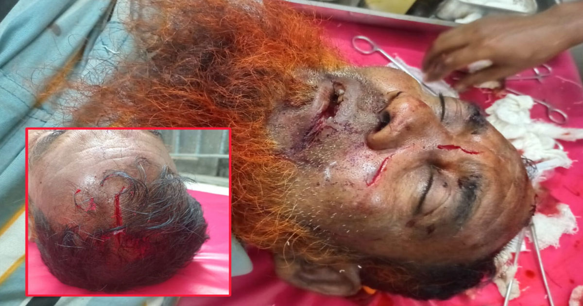 কুড়িগ্রামের উলিপুরে জমি নিয়ে বিরোধে হামলায় গুরুতর আহত ১