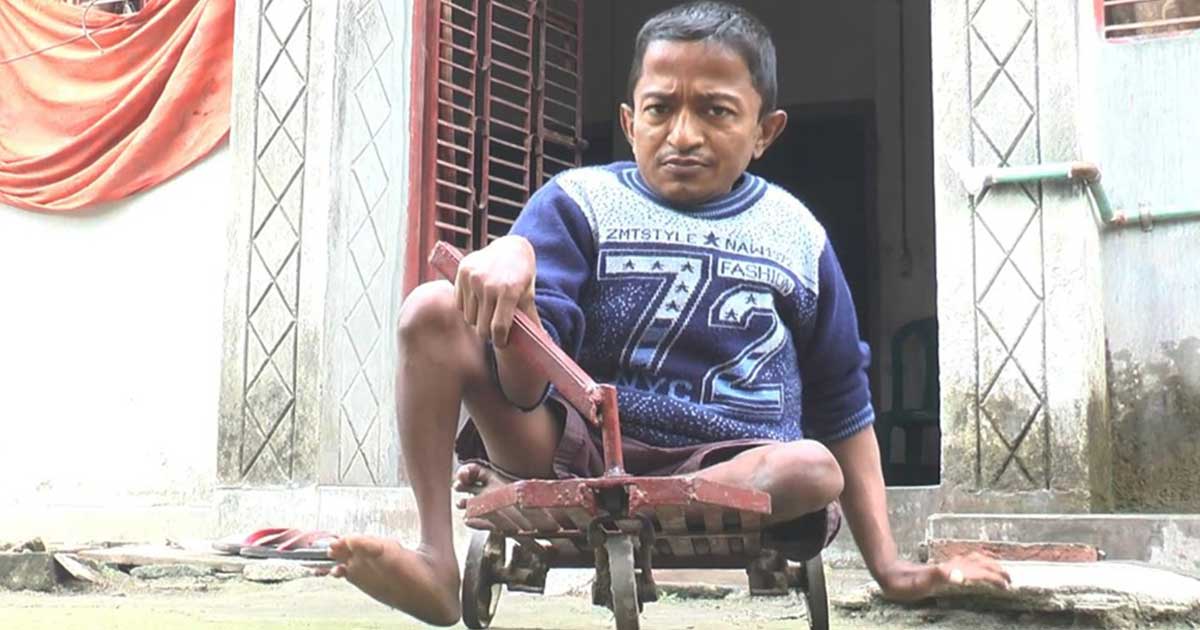 ২ ফিট উচ্চতার প্রতিবন্ধী সিজারের কষ্টের জীবন