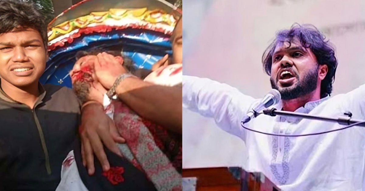 কানের নিচে গুলি লেগে গুরুতর হাদি, ঢামেকে নিবিড় পর্যবেক্ষণে