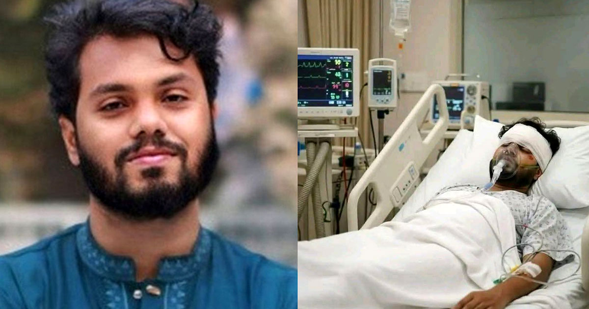 হাদির মস্তিষ্কের অবস্থা ‘খুবই খারাপ’, বিদেশে নেয়ার চিন্তা