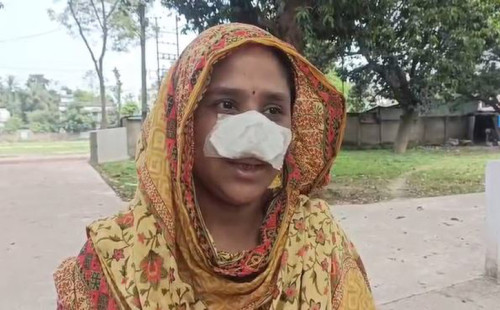 স্ত্রীর নাক সুন্দর, তাই ঘুমন্ত অবস্থায় নাক কামড়ে নিলো স্বামী