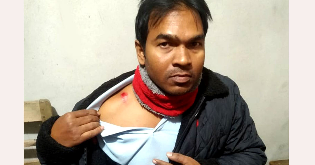 পরীক্ষার অযোগ্য বলায় মাদ্রাসা শিক্ষককে হাতুড়িপেটা