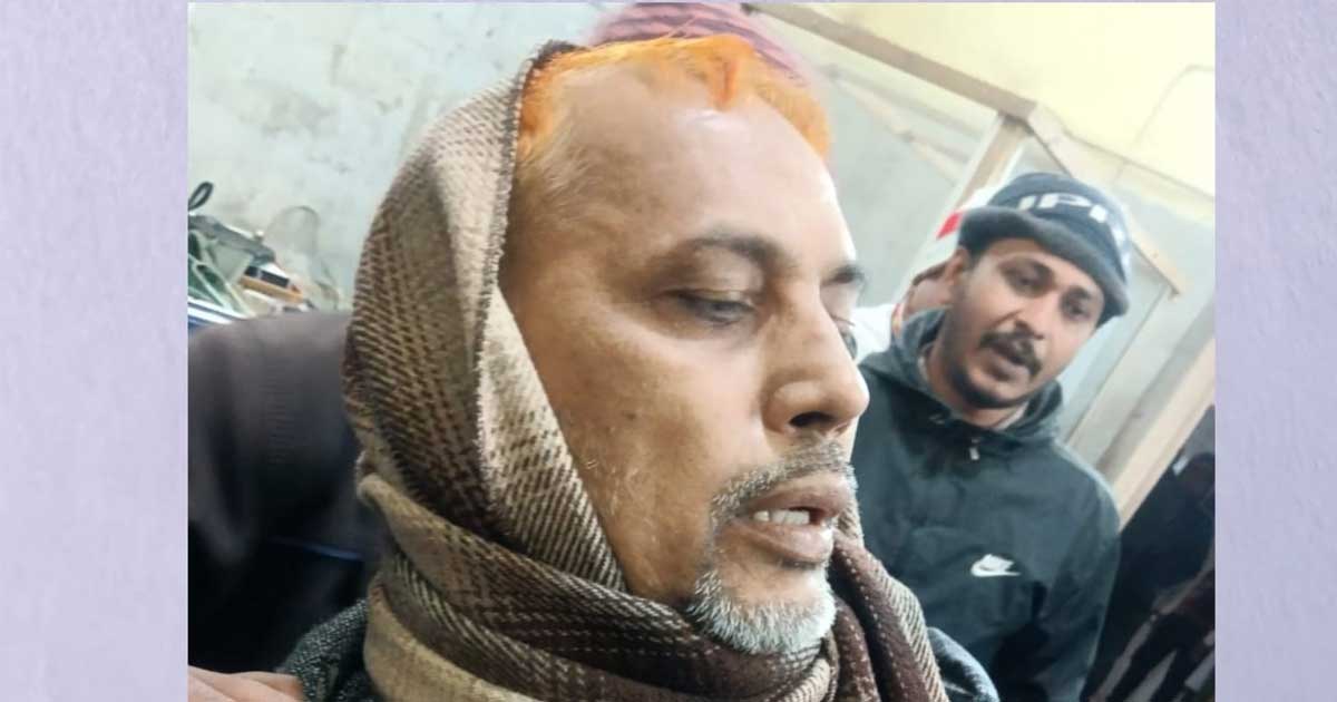 ঝিনাইদহের মহেশপুরে সোনা চোরাচালান বিরোধে আবারও গুলিবিদ্ধ মতি