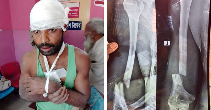 নোয়াখালীতে কৃষককে কুপিয়ে জখম
