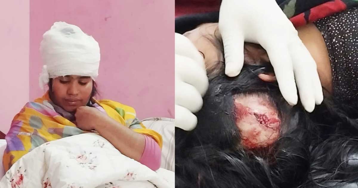 কাপাসিয়ায় সড়ক দুর্ঘটনায় দুই শিক্ষক গুরুতর আহত