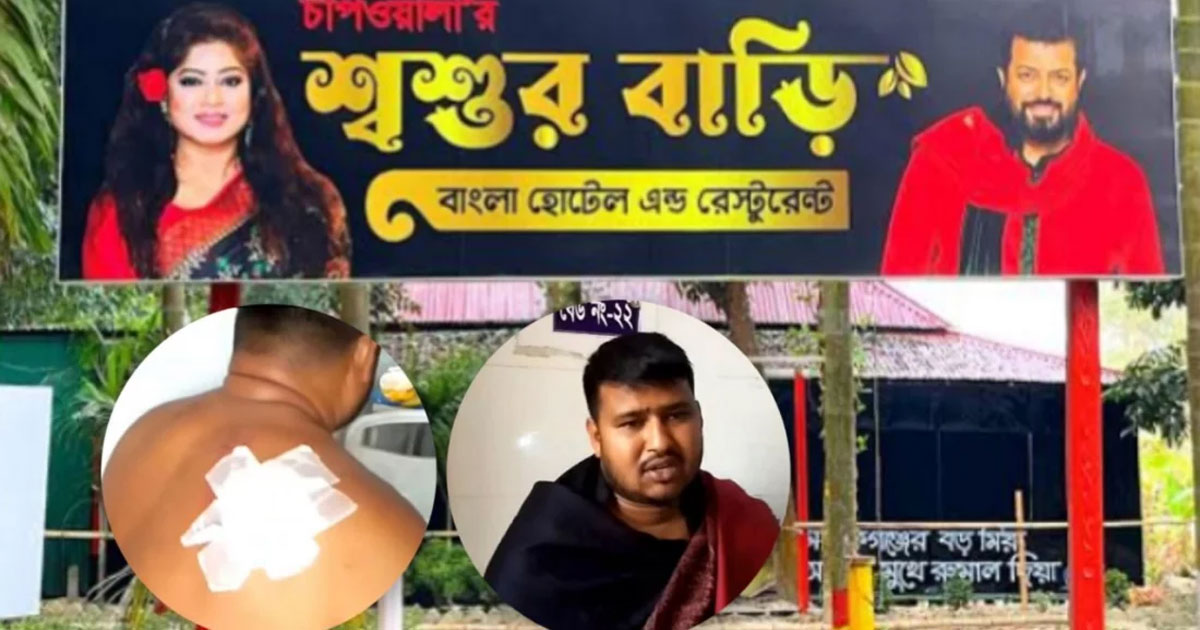 ওমর সানীর রেস্তোরাঁয় কাস্টমারকে কুপিয়ে জখম