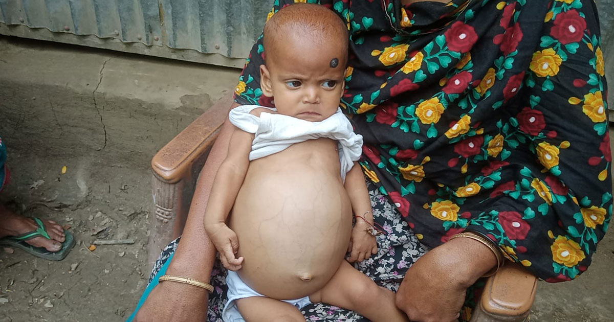 মোল্লাহাটে অসহায় শিশুর জীবন বাঁচাতে মানবিক সহায়তার আকুতি