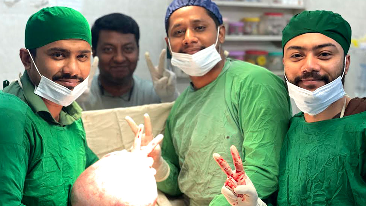 চাঁদপুরে নারীর পেটের ৮ কেজি ওজনের টিউমার অপসারণ