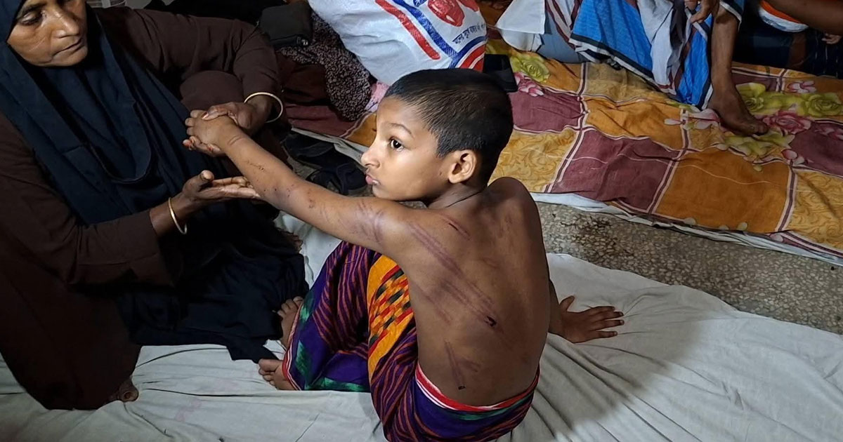 গোসল করতে অনীহা: পিটিয়ে রক্তাক্ত করলেন শিক্ষক
