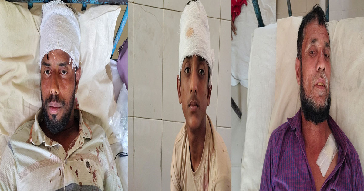 জমির আইল কাটাকে কেন্দ্র করে সংঘর্ষ, আহত ৩
