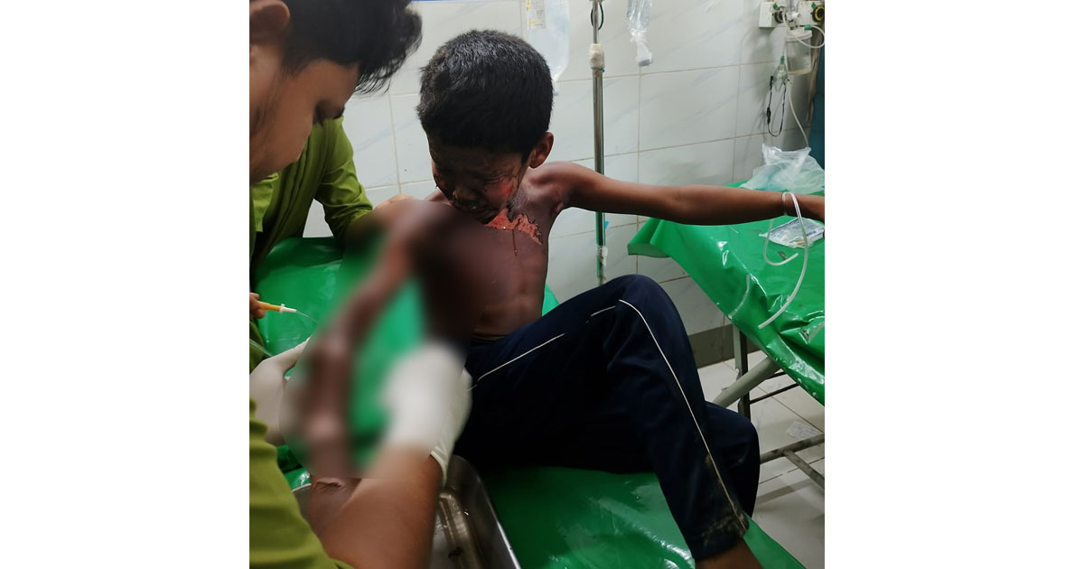 পাখির বাসা দেখতে গিয়ে বিদ্যুতায়িত  শিশু