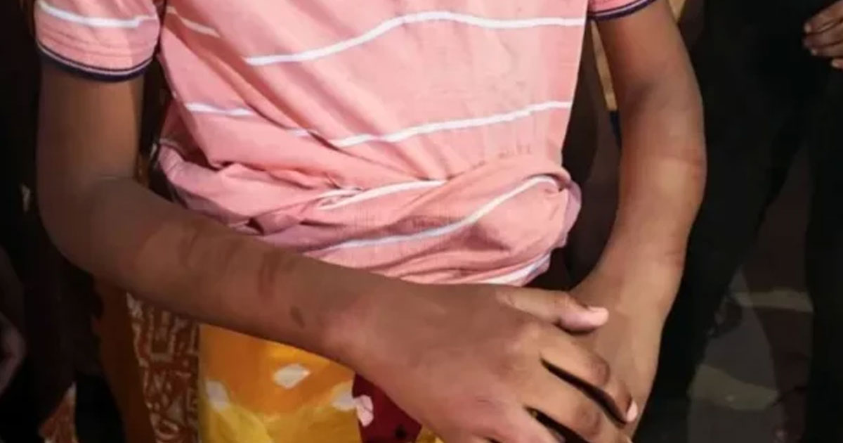 আক্কেলপুরে মাদ্রাসাছাত্রকে নির্যাতন, শিক্ষক পলাতক