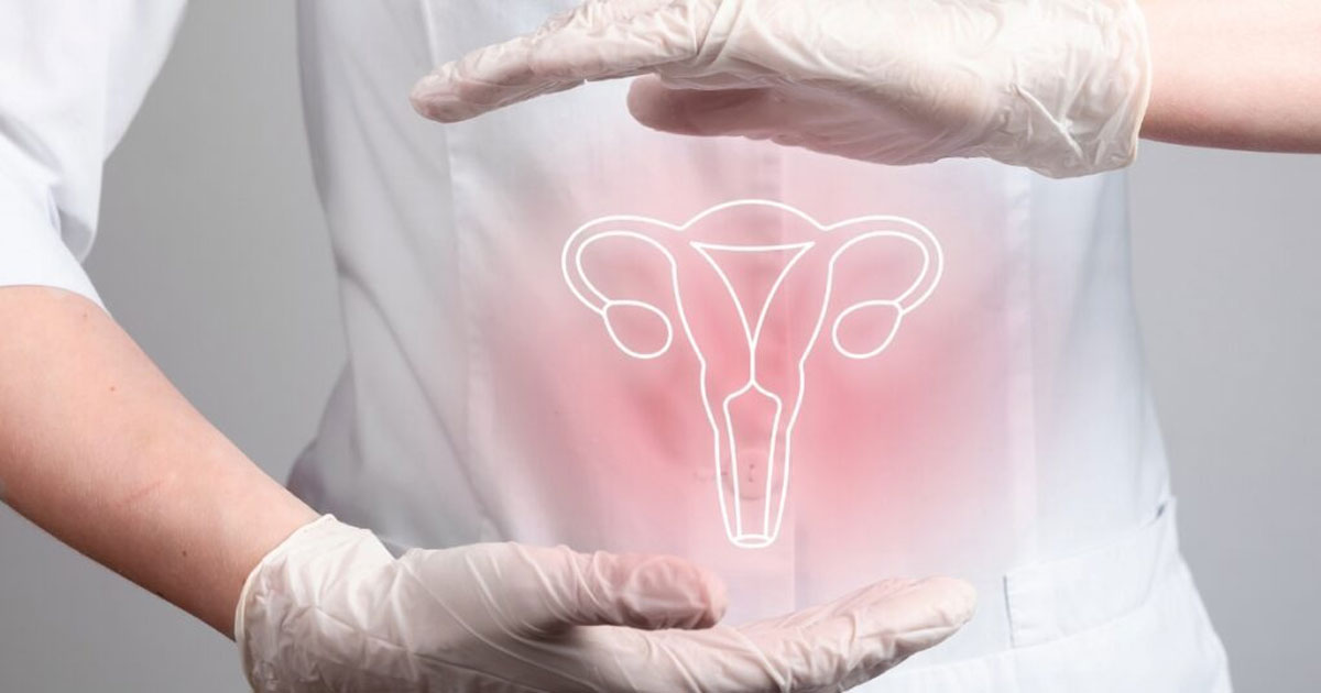 এন্ডোমেট্রিওসিসের ব্যথা কমাতে যা খাবেন