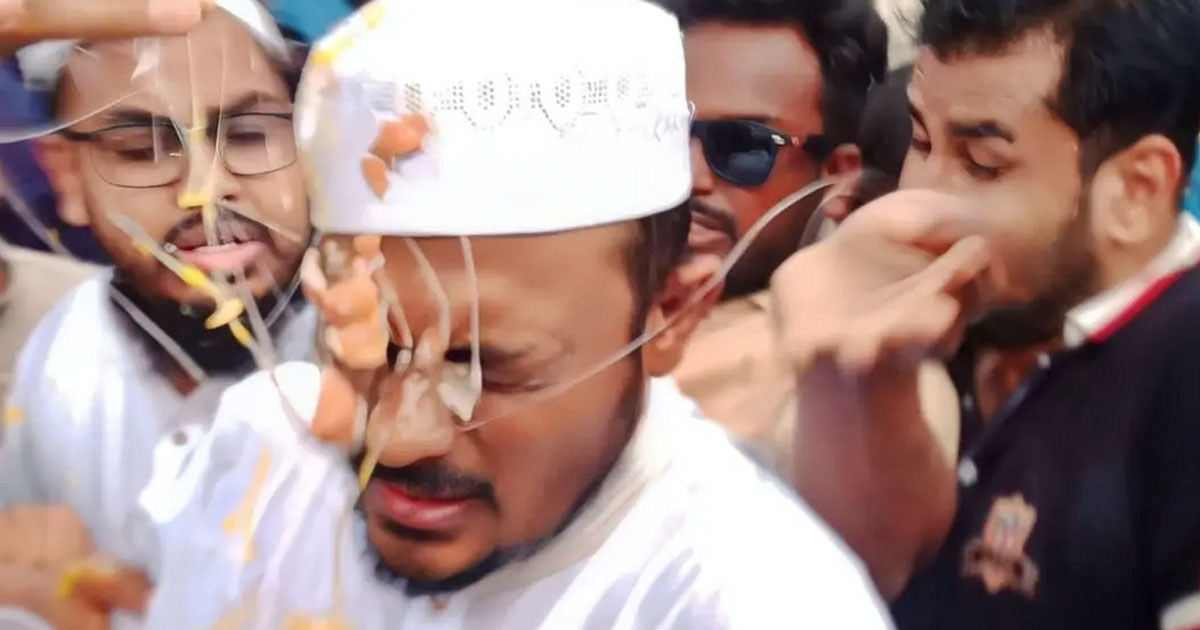 নাসীরুদ্দীন পাটওয়ারীর ওপর ডিম হামলা