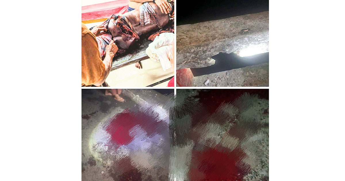 বদলগাছীতে বজ্রপাতে গুরুতর আহত ১