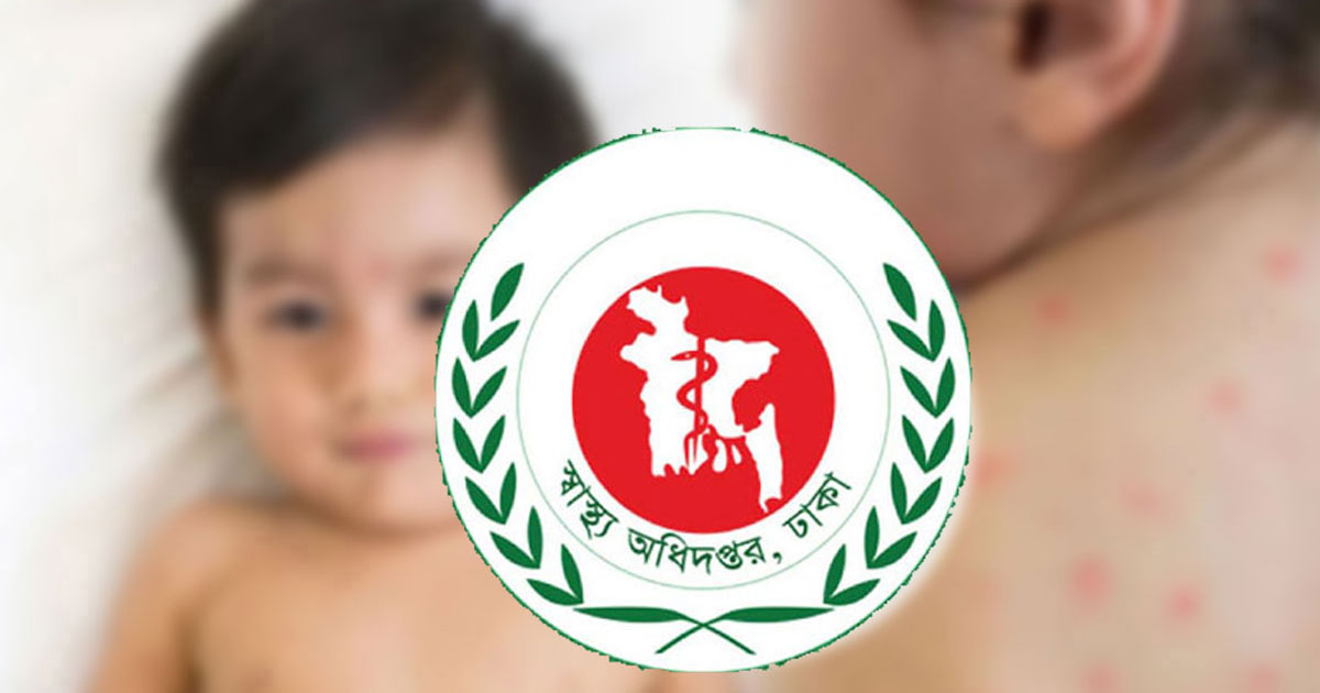 দেশে হাম ও উপসর্গে আরও ৯ শিশুর মৃত্যু