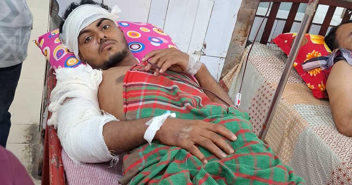 চাঁদপুরে প্রকাশ্যে যুবককে কুপিয়ে হত্যাচেষ্টা, পা হারানোর শঙ্কা