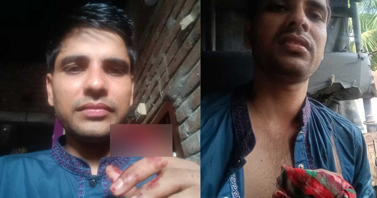 জমি নিয়ে বিরোধ: যুগান্তরের অফিস এক্সিকিউটিভসহ আহত ৩