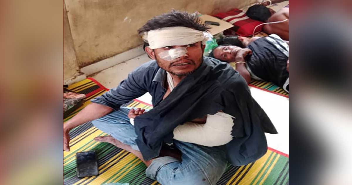 বেনাপোলের পল্লীতে বড় ভাইকে কুপিয়ে জখম করেছে ছোট ভাই