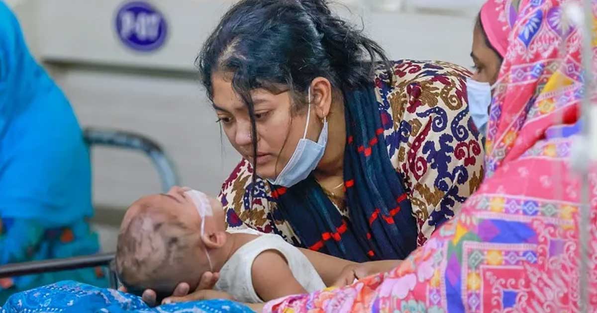 হাম উপসর্গে শিশুমৃত্যু ৭০০ ছাড়াল