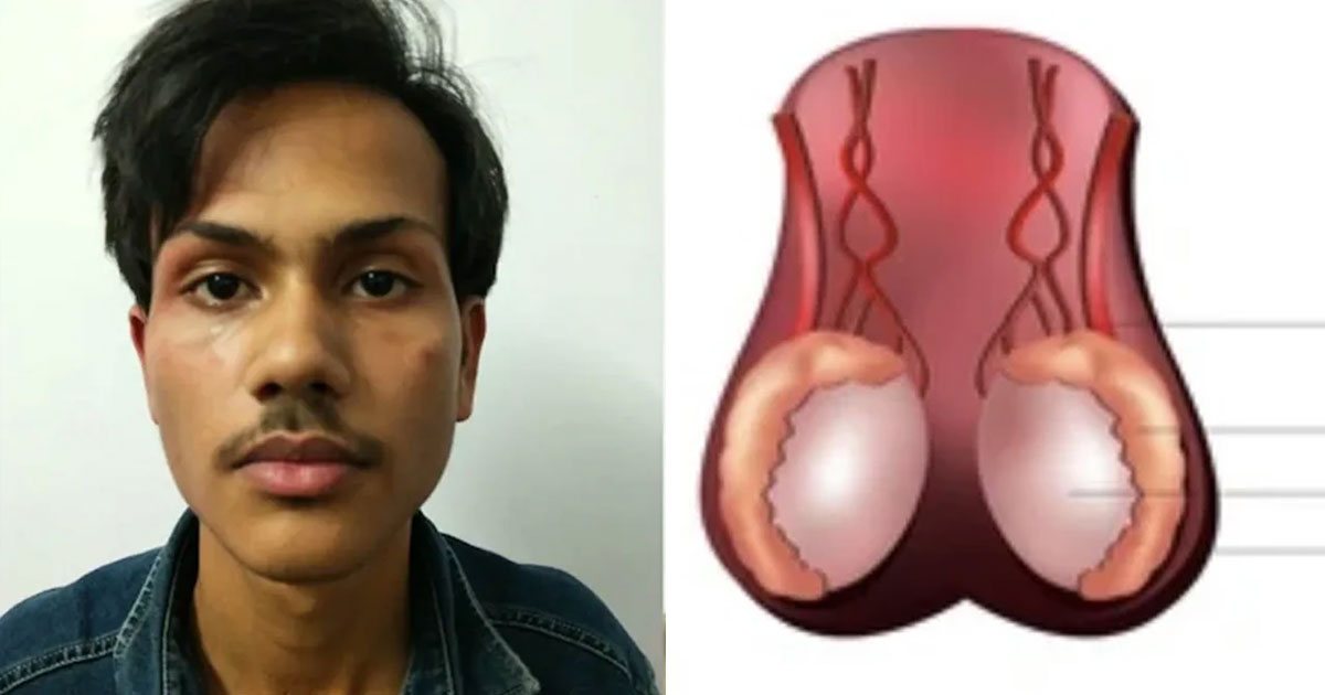 কোটি টাকার আশায় কিশোরের অণ্ডকোষ ছিনতাই