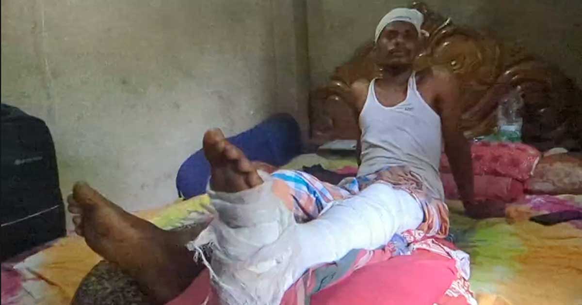 মাদক সেবনে বাধা দেওয়ায় যুবককে কুপিয়ে জখম
