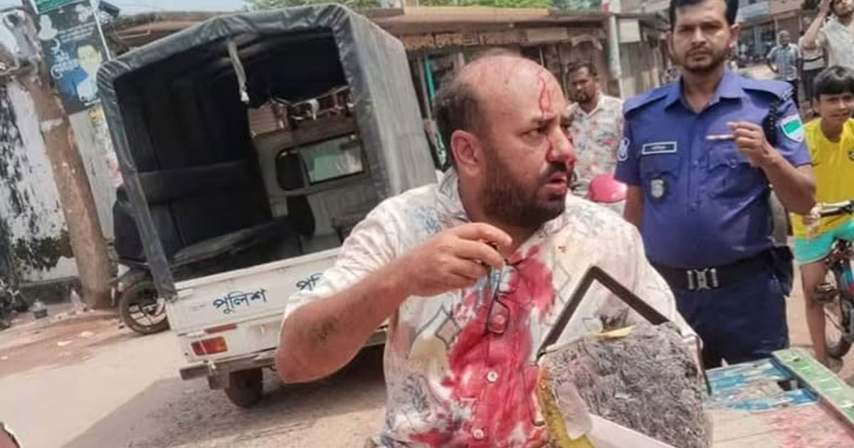 কুষ্টিয়ায় এমপির স্বজনদের বিরুদ্ধে সাংবাদিক কে মারধরের অভিযোগ