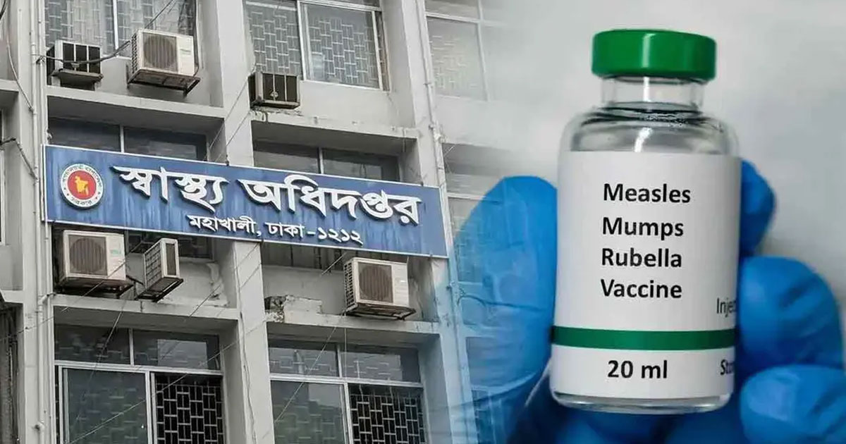 হাম ও হামের উপসর্গ নিয়ে দেশে মৃত্যু ছাড়ালো ১১০০