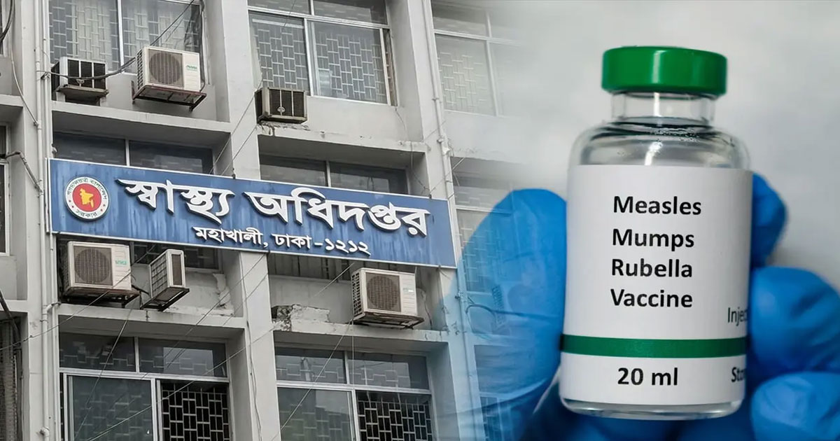 হাম উপসর্গে ৭ জনের মৃত্যু, হাসপাতালে ভর্তি ১২৭৩