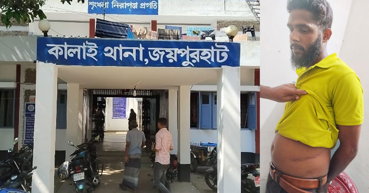 ট্রান্সফরমার চুরির মামলায় গ্রেপ্তার ছামছুল, বেরিয়ে আসলো কিডনি বিক্রির লোমহর্ষক কাহিনী