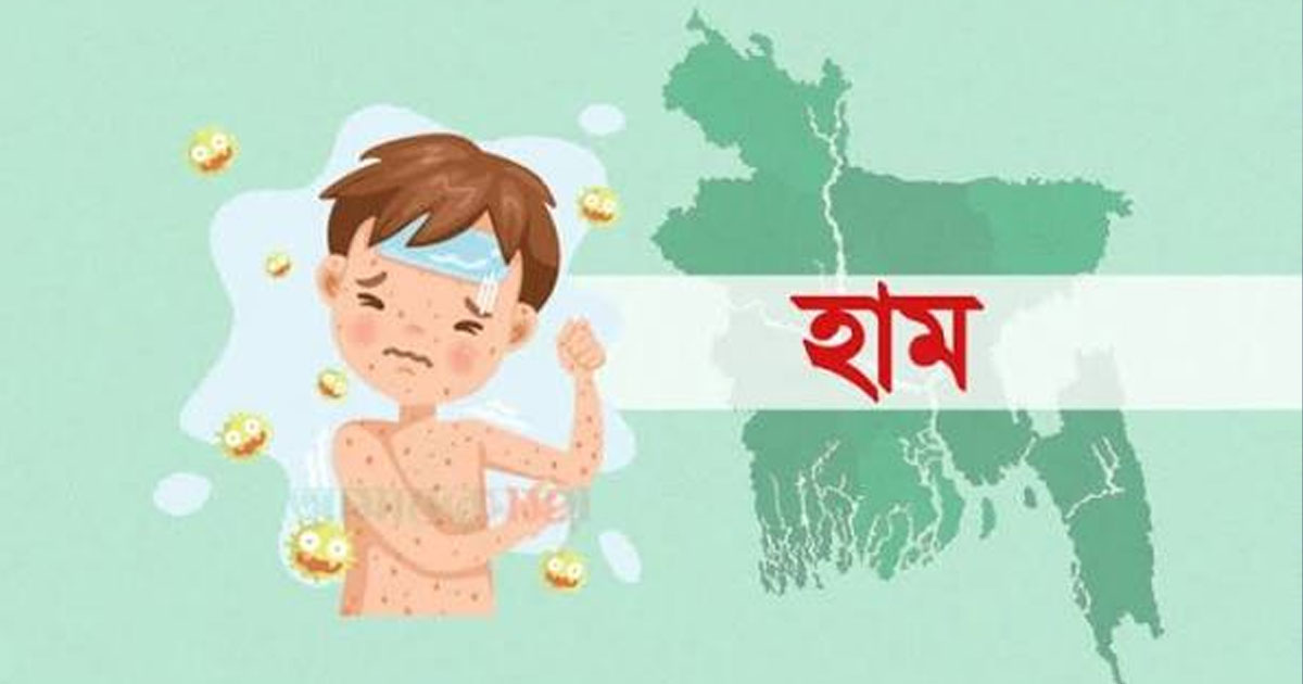 হাম উপসর্গে আরও ৮ জনের মৃত্যু