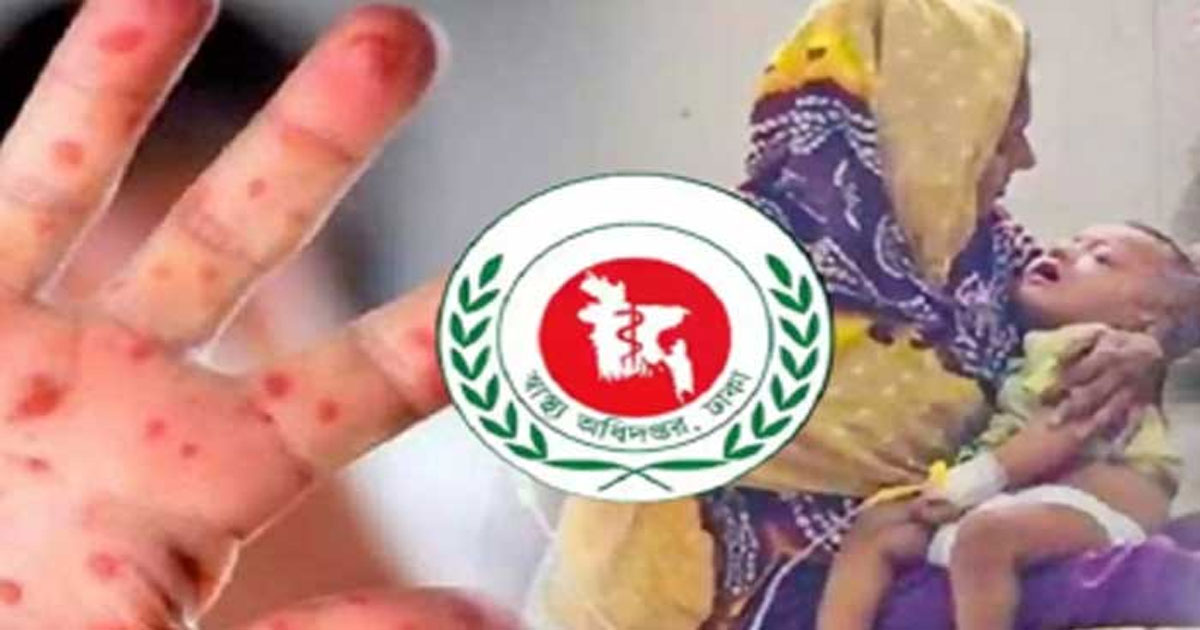 দেশে হাম ও হাম সন্দেহে শিশু মৃত্যু আড়াইশ ছাড়াল