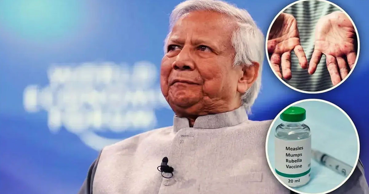 ইউনূস সরকারের আমলেও ছিল টিকা, যে কারণে দেওয়া হয়নি