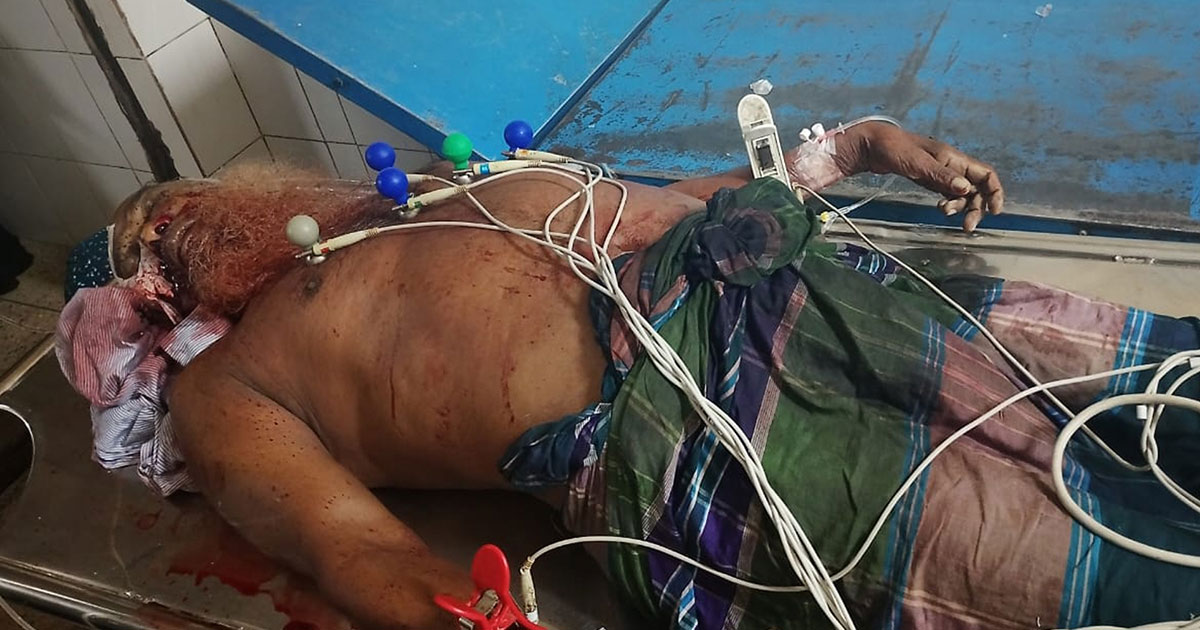 চাঁদপুরে অটোরিকশার ওপর গাছ পড়ে যাত্রী নিহত